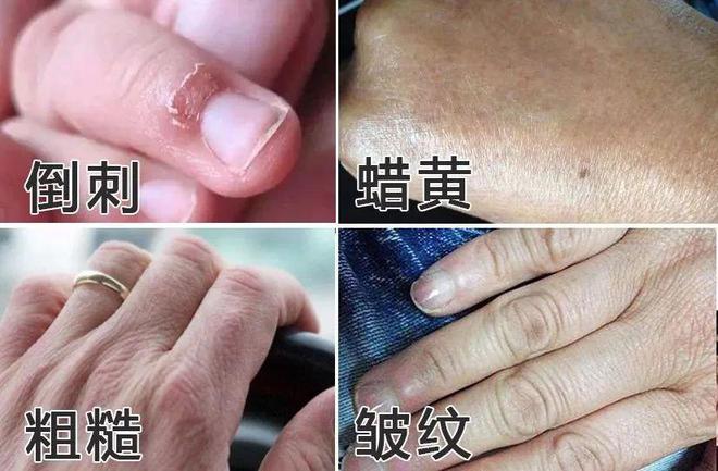 霜！跪求你买这8支好用到想报警！AG真人游戏平台冬日的第一支护手(图3)