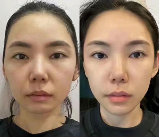 推荐2024最值得入手的抗皱国货分享AG真人澳门百家家乐抗老去皱纹护肤品