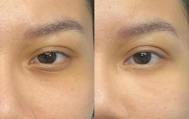 好？眼纹党必看买对不买贵的抗初老眼霜AG真人百家家乐平台什么眼霜去皱效果(图3)